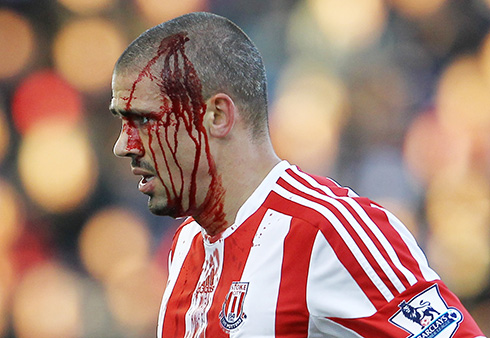 Stoke2
